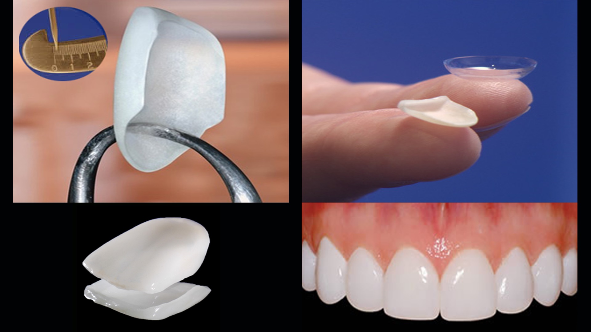 Cosmetic Dentistry